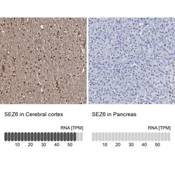 SEZ6/BSRP-C Antibody, Novus Biologicals 0.1mL; Unlabeled:Antibodies, Polyclonal